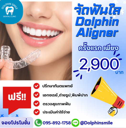 จัดฟันใส 2