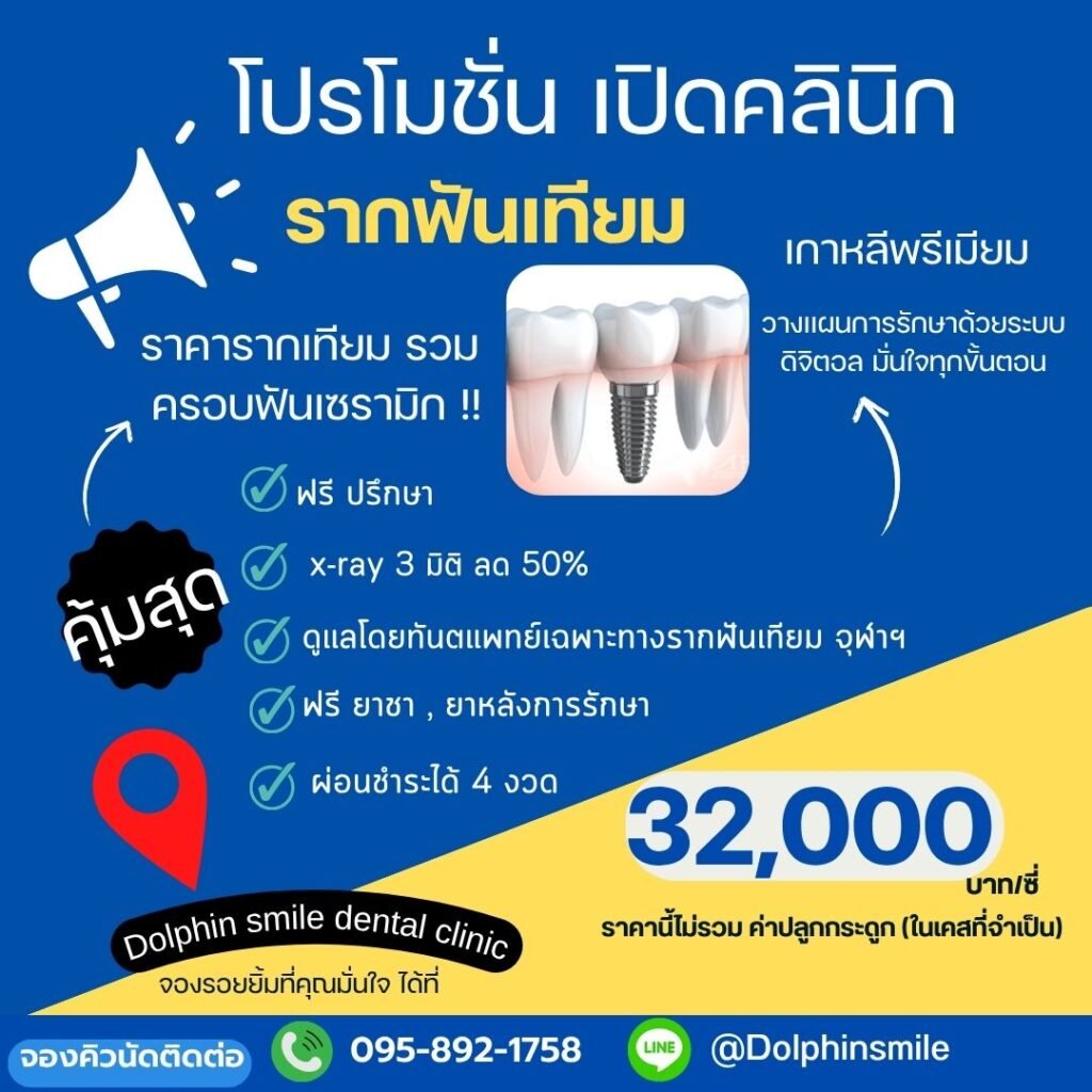 รากเทียม