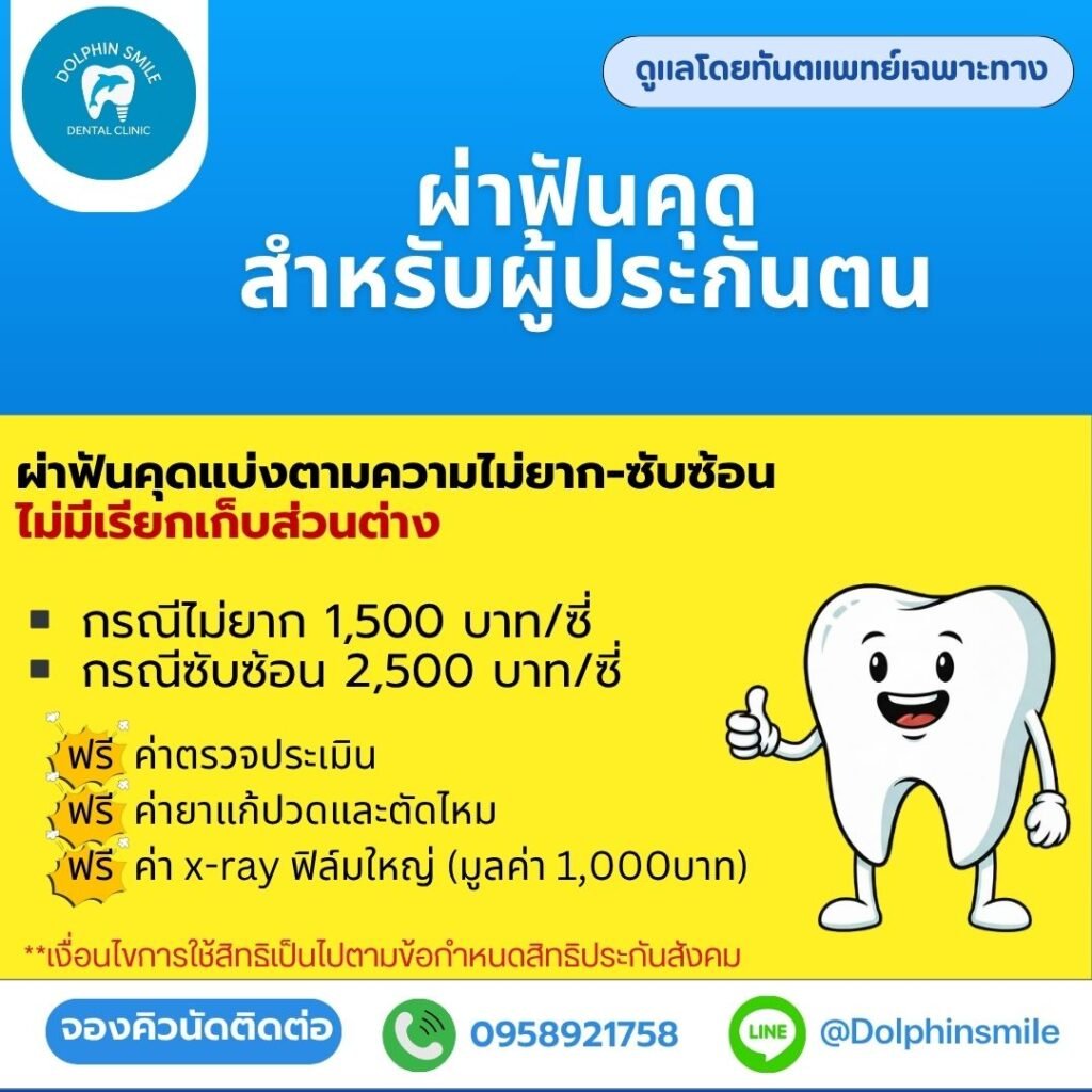 โปรโมชั่น (4)