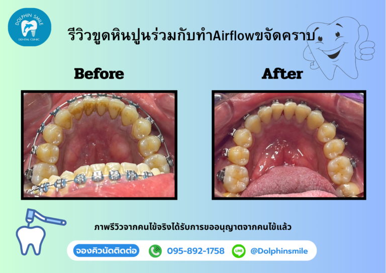 gift voucher รีวิวบริการ (1)