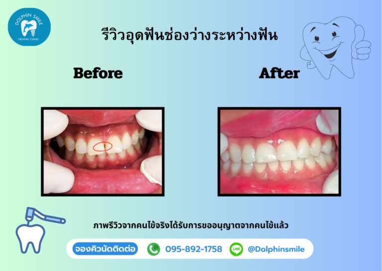 gift voucher รีวิวบริการ (2)