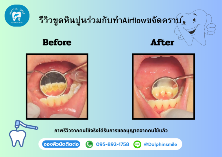 gift voucher รีวิวบริการ