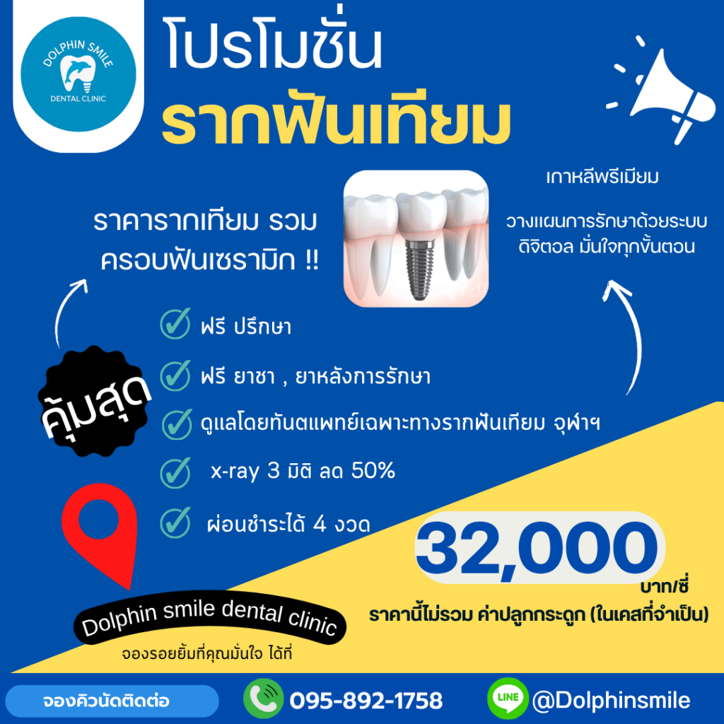 โปรโมชั่น (17)