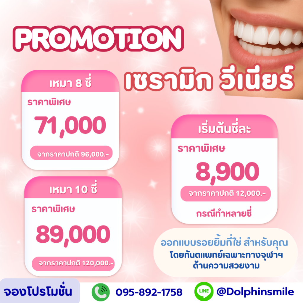 โปรโมชั่น (22)