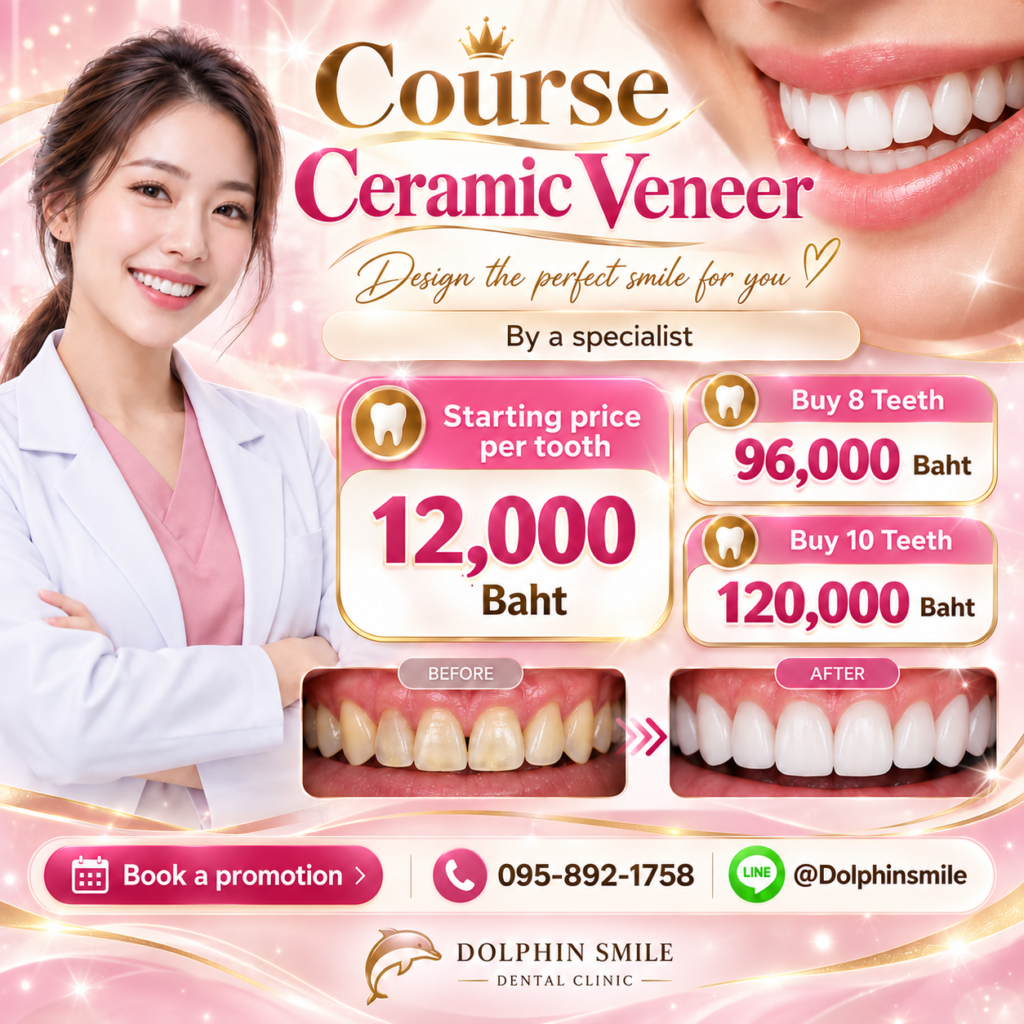 ceramic veneer smile promotion